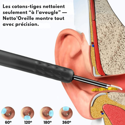 Netto’Oreille - Nettoyeur d’Oreilles Intelligent HD