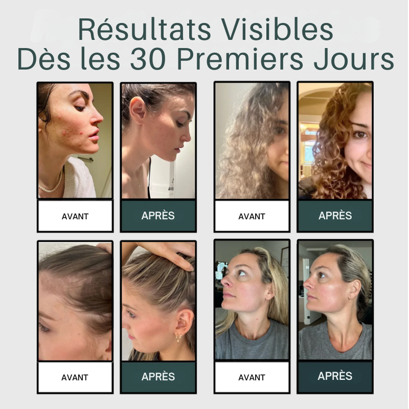 Sauvez Votre Peau, Vos Cheveux et Votre Bien-Être de l’Eau Calcaire