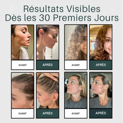 Sauvez Votre Peau, Vos Cheveux et Votre Bien-Être de l’Eau Calcaire